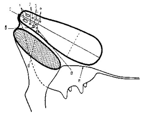 Схема блокады наружного семенного, ветвей промежноснтого, подвздошно-подчревного и подвздошно-пахового нервов