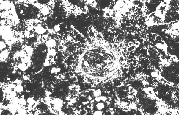 Гистотопограмма диафиза бедренной кости курицы (240 суток) гематоксилин и эозин, МБИ-6, х80: 1 – лимфоидный узелок (Криштофорова Б. В., 1992)