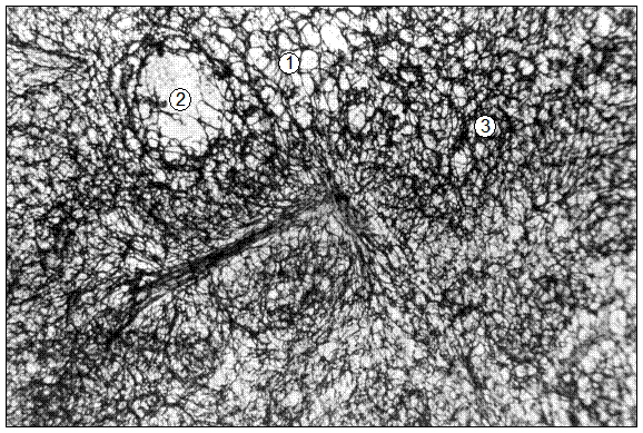 Гистотопограмма повздошно-ободочнокишечного лимфатического узла поросенка (сутки, ІІІ). Гематоксилин и эозин, МБИ-6, х80: 1 – ретикулярный остов диафизной лимфоидной ткани корковой зоны; 2 – ретикулярный основа лимфоидного узелка без центра размножения; 3 – ретикулярная основа мозговой зоны
