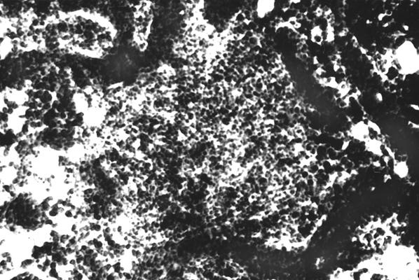 Гистотопограмма диафиза бедренной кости курицы (180 суток) гематоксилин и эозин, МБИ-6, х80: 1 – диффузная лимфоидная ткань (Криштофорова Б. В., 1992)