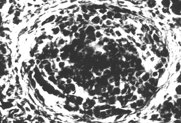 Гистотопограмма диафиза бедренной кости курицы (240 суток) гематоксилин и эозин, МБИ-6, х400: 1 – лимфоидный узелок, окруженный ретикулярными волокнами (Криштофорова Б. В., 1992)