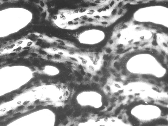 Гистотопограмма компактной костной ткани теленка (сутки). Импрегнация серебром. МБИ-6, х400