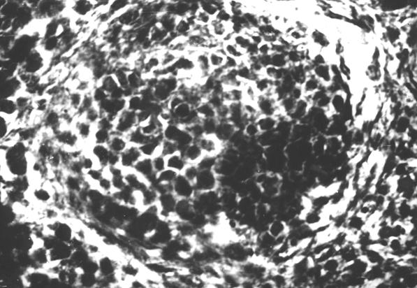 Гистотопограмма диафиза бедренной кости курицы (240 суток) гематоксилин и эозин, МБИ-6, х400: 1 – лимфоидный узелок с 2 – розетковидными центрами (Криштофорова Б. В., 1992)