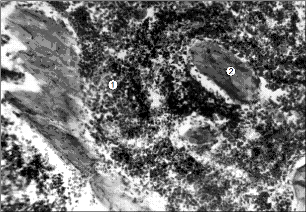 Гистотопограмма 8-го грудного позвонка поросенка (сутки). Гематоксилин и эозин, МБИ-6, х80: 1 – скопление красного костного мозга; 2 – трабекула вторичной губчатой костной ткани (В. Г. Соколов, 2003)