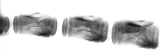 Рентгенограмма первых трех хвостовых позвонков суточной телочки (П. Н. Гаврилин, 1992): 1 – эпифизарные (головки и ямки); 2 – диафизарные центры окостенения