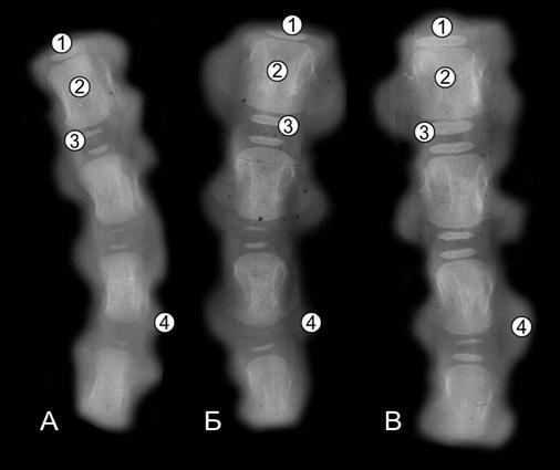Рентгенограммы І-ІV хвостовых позвонков 5- (А), 10- (Б) и 20 (В) суточных телочек (Ж. Г. Грабчак, 2004): 1 – краниальный центр окостенения; 2 – диафизарный центр окостенения; 3 – каудальный центр окостенения; 4 – хрящевая ткань