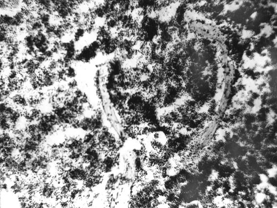 Гистотопограмма грудины телочки (сутки) с высоким морфофункциональным статусом организма (В. В. Смоляк, 2000): 1 – красный костный мозг