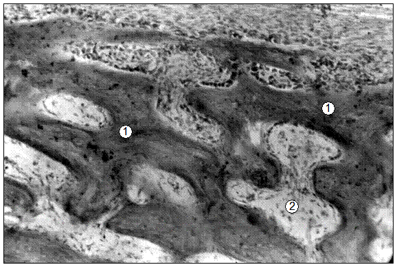 Гистотопограмма средней части диафиза бедренной кости поросенка (10 суток). Гематоксилин и эозин. МБИ-6, х80: 1 – трабекула компактной КТ; 2 – рыхлая волокнистая соединительная ткань