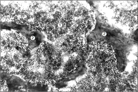 Гистотопограмма диафиза 9 грудного позвонка поросенка (сутки). Гематоксилин и эозин. МБИ-6, х80: 1 – ККМ; 2 – трабекули вторичной губчатой КТ