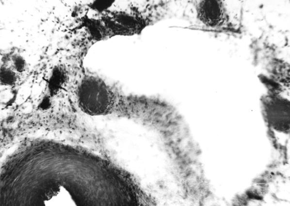 Фронтальный срез диафизарной артерии и вены паравенозного артериального сплетения плечевой кости теленка. Гематоксилин и эозин, МБИ-6, 10х8 (Б. В. Криштофорова, 1974)