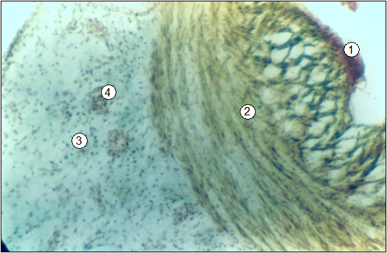 Гистотопограма пупочной вены поросенка (сутки). Гематоксилин-пикроиндигокармин. МБИ-6, 10х8 (В. В. Лемещенко): 1 – внутренняя оболочка; 2 – средняя оболочка; 3 – внешняя оболочка и параумбиликальная соединительная ткань; 4 – параумбиликальные кровеносные сосуды