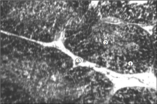 Гистотопограмма тимуса щенка собак (сутки). МБИ-6, х80. 1. Корковая зона. 2. Мозговая зона. 3. Междольковая рыхлая соединительная ткань