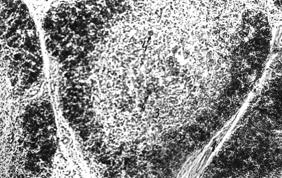 Гистотопограмма тимуса телочки (сутки) с пренатальным недоразвитием: 1 – корковая; 2 – мозговая зона