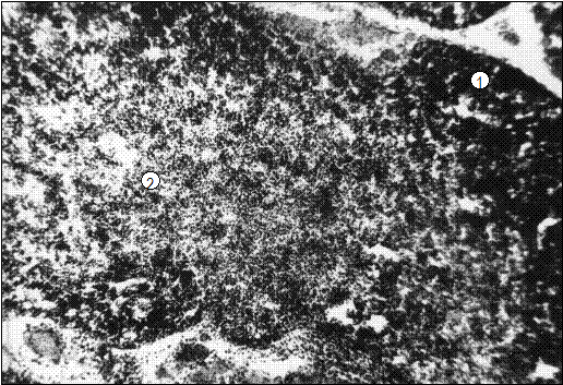 Гистотопограмма тимуса телочки (сутки) с высоким организменным статусом: 1 – корковая; 2 – мозговая зона