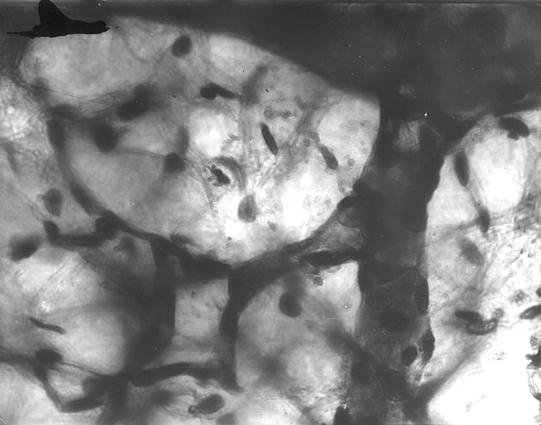 Слияние венозных ветвей в диафизарную вену плечевой кости теленка (сутки). Импрегнация свинцом. МБИ-6, 10х8