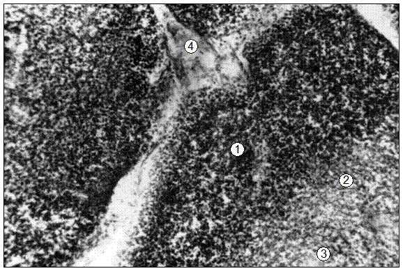 Гистотопограмма тимуса поросенка (сутки) с пренатальным недоразвитием. 1 – корковая зона; 2 – мозговая зона; 3 – тимическое тельце; 4 – соединительная ткань