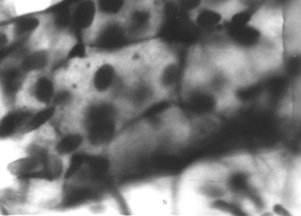 Стенка внутрикостной вены плечевой кости теленка (20 суток). Импрегнация свинцом. МБИ-6, 7х40