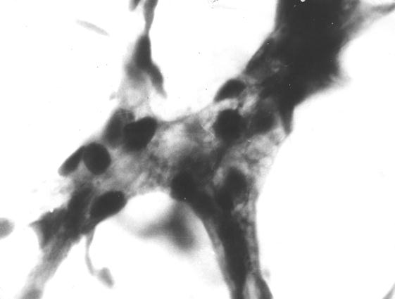 Посткапиляры и венула плечевой кости теленка (сутки). Импрегнация свинцом. МБИ-6, 10х20