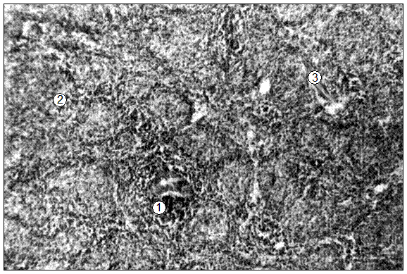 Гистотопограмма селезенки поросенка (сутки). Гематоксилин и эозин, МБИ-6, х80: 1 – первичный лимфоидный узелок; 2 – красная пульпа; 3 – трабекула