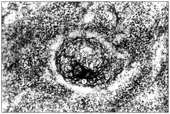 Гистотопограмма селезенки поросенка (сутки). Импрегнация серебром, МБИ-6, х80: – ретикулярный остов периартериальной лимфоидной муфты; 2 – ретикулярный остов первичного лимфоидного узелка