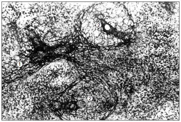 Гистотопограмма селезенки поросят (20 суток). Импрегнация серебром: 1 – ретикулярная строма периартериальной лимфоидной муфты; 2 – ретикулярная строма лимфоидного узелка без центра размножения