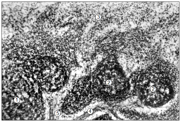 Гистотопограмма поверхностного шейного лимфатического узла поросенка (сутки). Гематоксилин и эозин, МБИ-6,Х80: 1 – диффузная лимфоидная ткань корковой зоны; 2 – лимфоидные узелки с центрами размножения; 3 – мозговая зона; 4 – трабекула; 5 – корковый синус