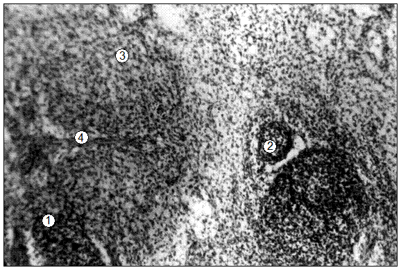 Гистотопограмма поверхностного шейного ЛВЗ поросенка (сутки). Гематоксилин и эозин, МБИ-6, х80: 1 – диффузная лимфоидная ткань корковой зоны; 2 – лимфоидные узелки без центра размножения; 3 – мозговая зона; 4 – трабекула