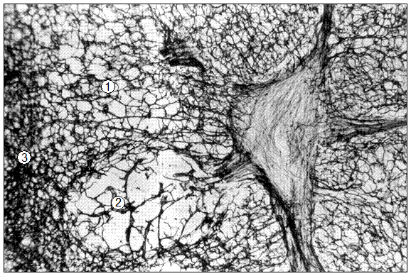  Гистотопограмма подвздовшно-ободочнокишечного лимфатического узла поросенка (сутки). Гематоксилин и эозин, МБИ-6, х80: 1 – ретикулярная основа диффузной лимфоидной ткани корковой зоны; 2 – ретикулярная основа лимфоидного узелка без центра размножения; 3 – ретикулярный основа мозговой зоны