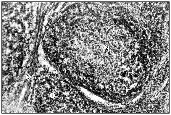 Гистотопограмма нижнечелюстного лимфатического узла поросенка (20 суток). Гематоксилин и эозин, МБИ-6, х80: 1 – диффузная лимфоидная ткань корковой зоны; 2 – лимфоидный узелок с центром размножения; 3 – трабекула