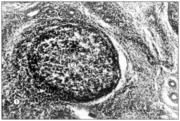 Гистотопограмма нижнечелюстного лимфатического узла поросенка (15 суток). Гематоксилин и эозин, МБИ-6, х80: 1 – диффузная лимфоидная ткань корковой зоны; 2 – лимфоидный узелок с центром размножения