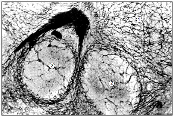  Гистотопограмма нижнечелюстного ЛУ поросенка (15 суток). Импрегнация серебром, МБИ-6, х80: 1 – ретикулярная основа ДЛТ корковой зоны; 2 – ретикулярная основа лимфоидных узелков с центрами размножения